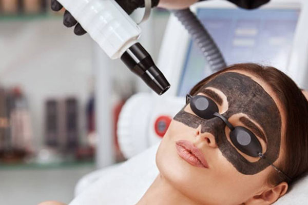 Carbon Peel laser