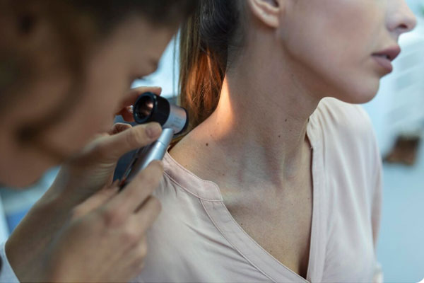 Mole Removal