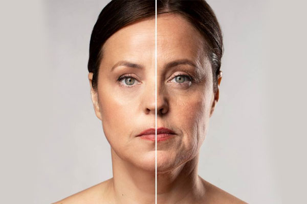 Anti-aging